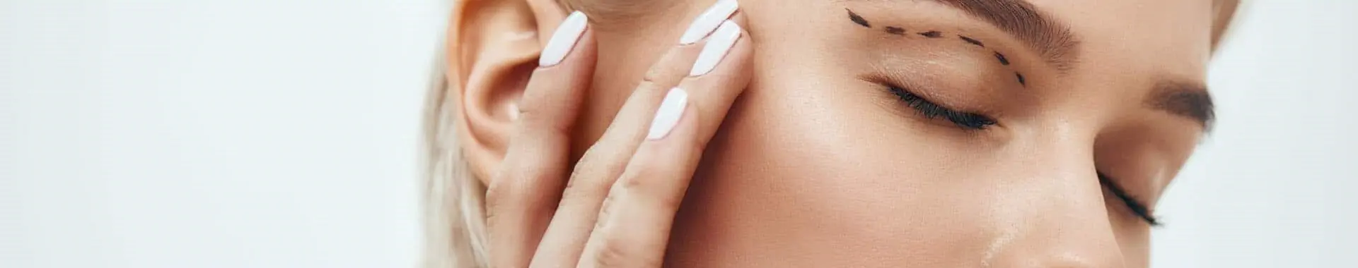 ניתוח להרמת עפעפיים