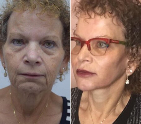 תמונת חוות דעת