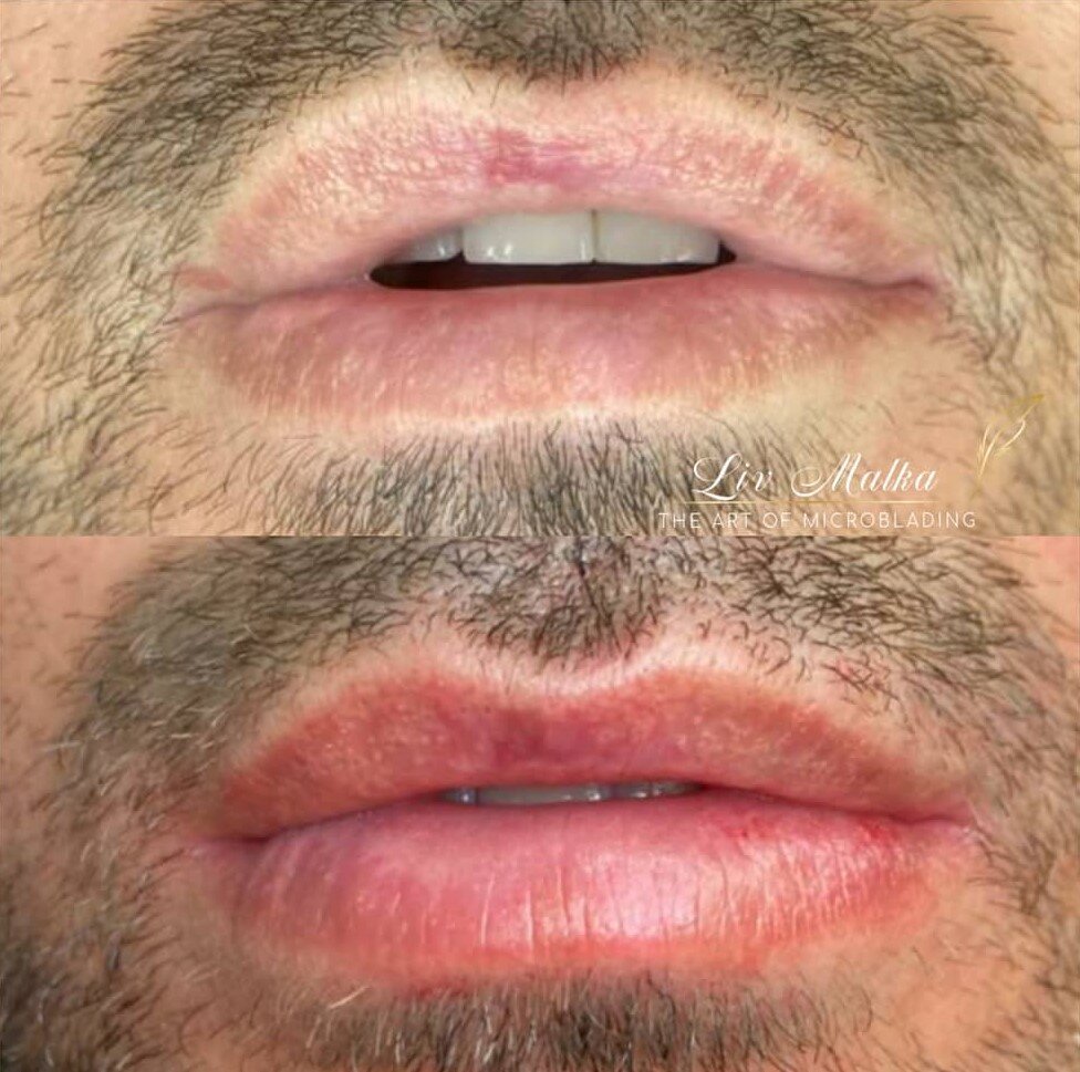 ליאת מזרחי - טיפול במיקרופיגמנטציה של שפתיים