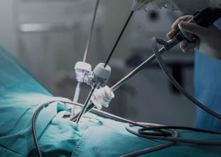 לפרוסקופיה (Laparoscopy)