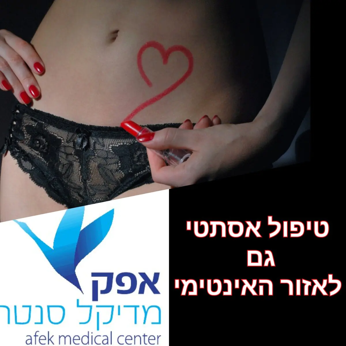 אפק מדיקל סנטר - הסרת סימני מתיחה בלייזר