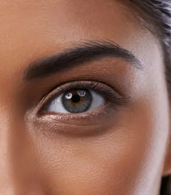 מילוי שקעי עיניים