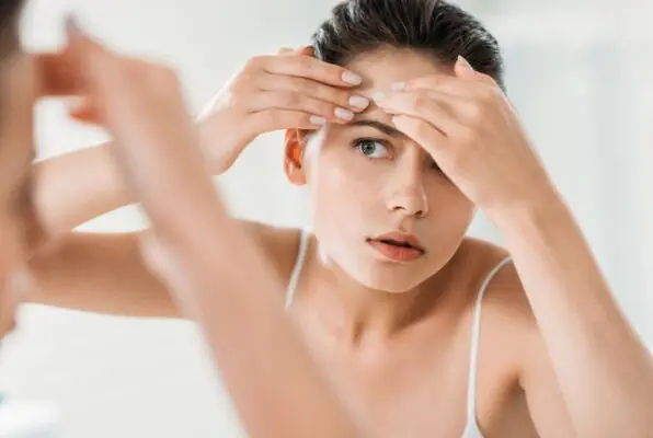 טיפול באקנה