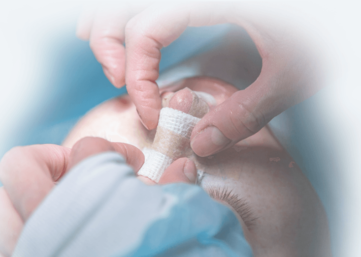 ד"ר ליהי שגיא - ניתוח פלסטי של האף