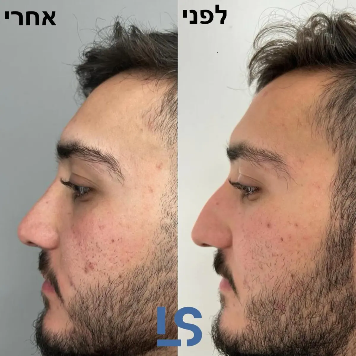 ד"ר ליהי שגיא - טיפולי בוטוקס